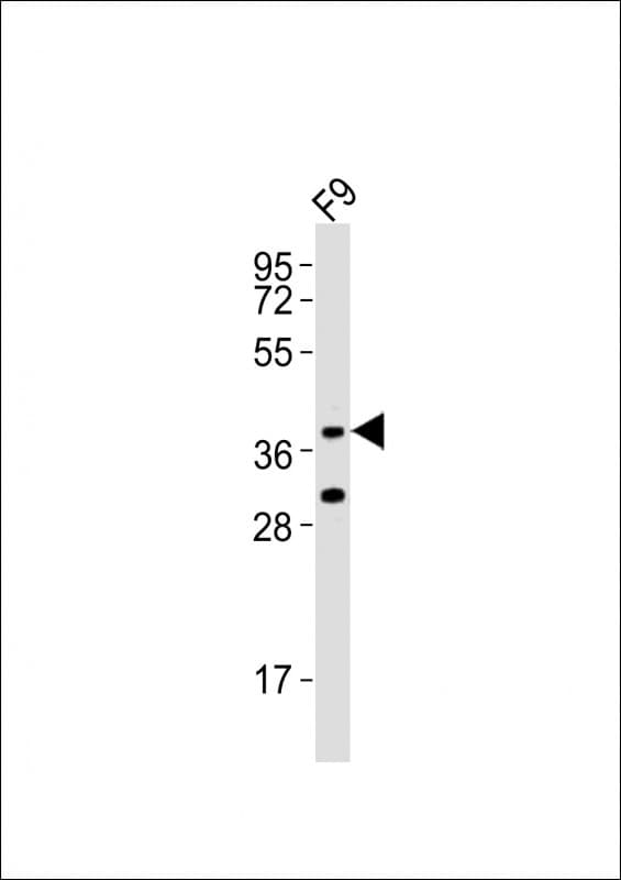 Polyclonal Rabbit anti-Mouse RNF2 / RING2 / RING1B Antibody (aa165-199, WB)