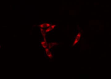 Polyclonal Rabbit anti-Human AIM2 Antibody (IF, WB)