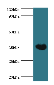 ARG1 / Arginase 1 Antibody (aa1-322)