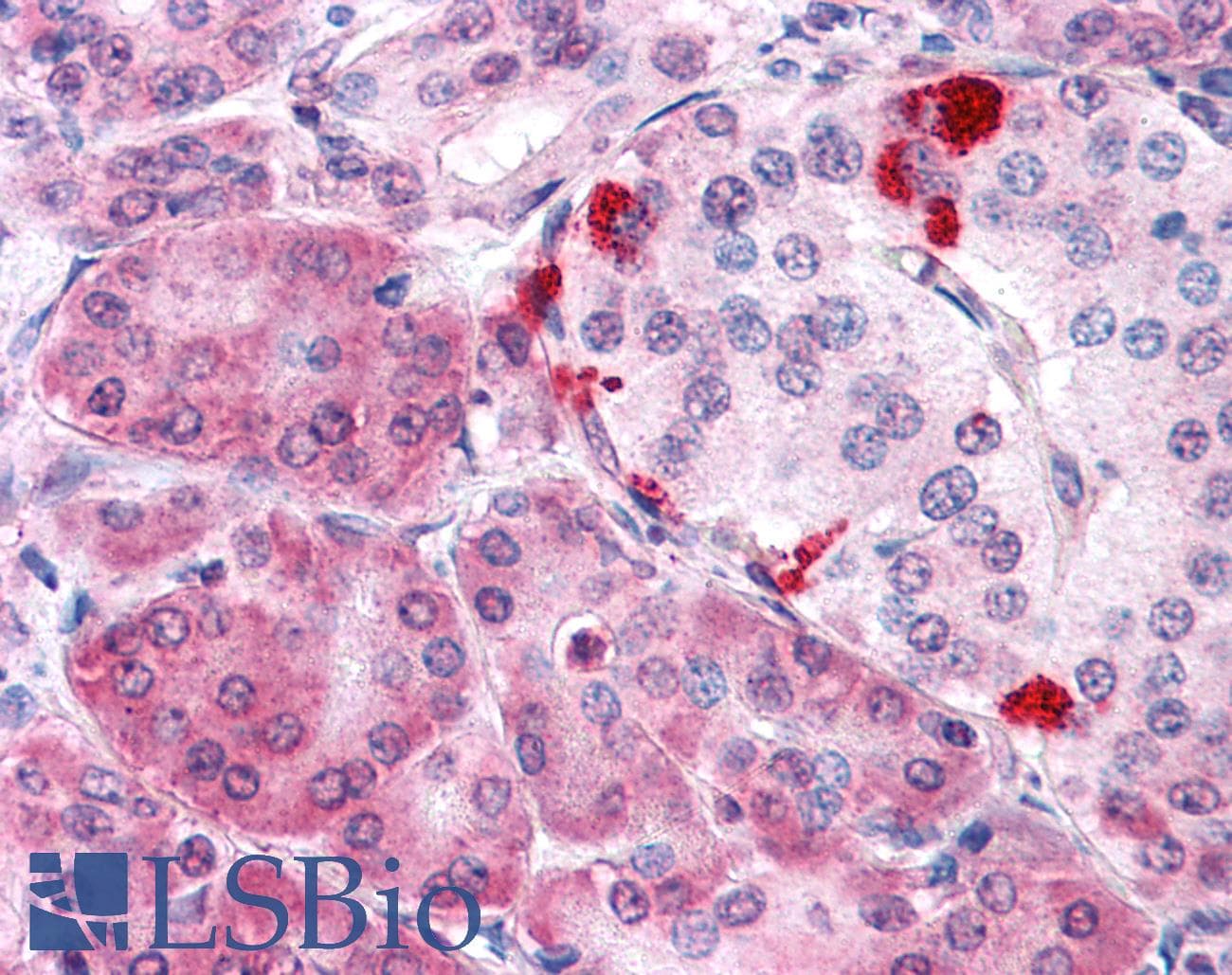 IHC-plus™ Polyclonal Rabbit anti-Human KIAA0152 / MLEC Antibody (Internal, IHC)