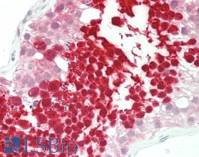 Polyclonal Rabbit anti-Human HSPA2 Antibody (aa504-553, IHC, WB)