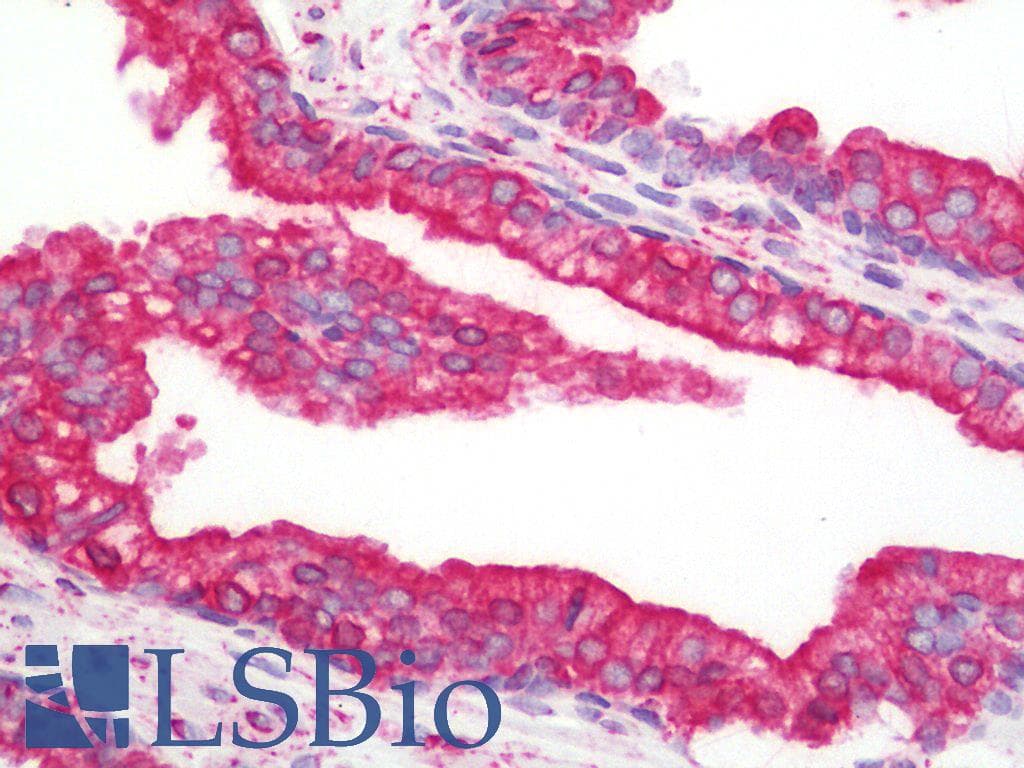 PathPlus™ CANX / Calnexin Antibody (C-Terminus)