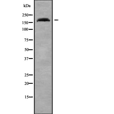 ADAMTS7 Antibody