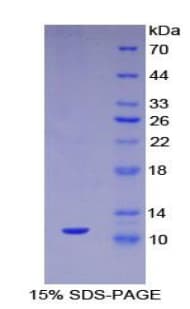 Mouse Mucin 2 / MUC2 Protein (Recombinant His)