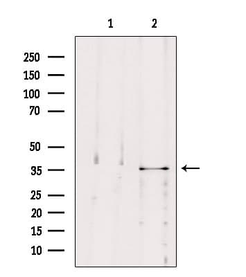 Polyclonal Rabbit anti-Human MAST4 Antibody (IHC, IF, WB)