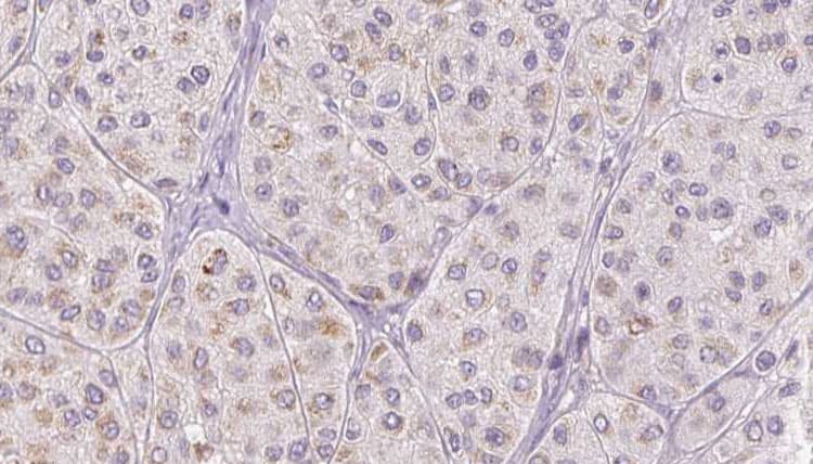 FGA / Fibrinogen Alpha Antibody