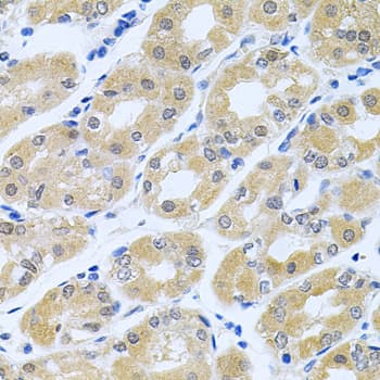 GLCNE / GNE Antibody