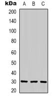 Polyclonal Rabbit anti-Human CNTF Antibody (WB)