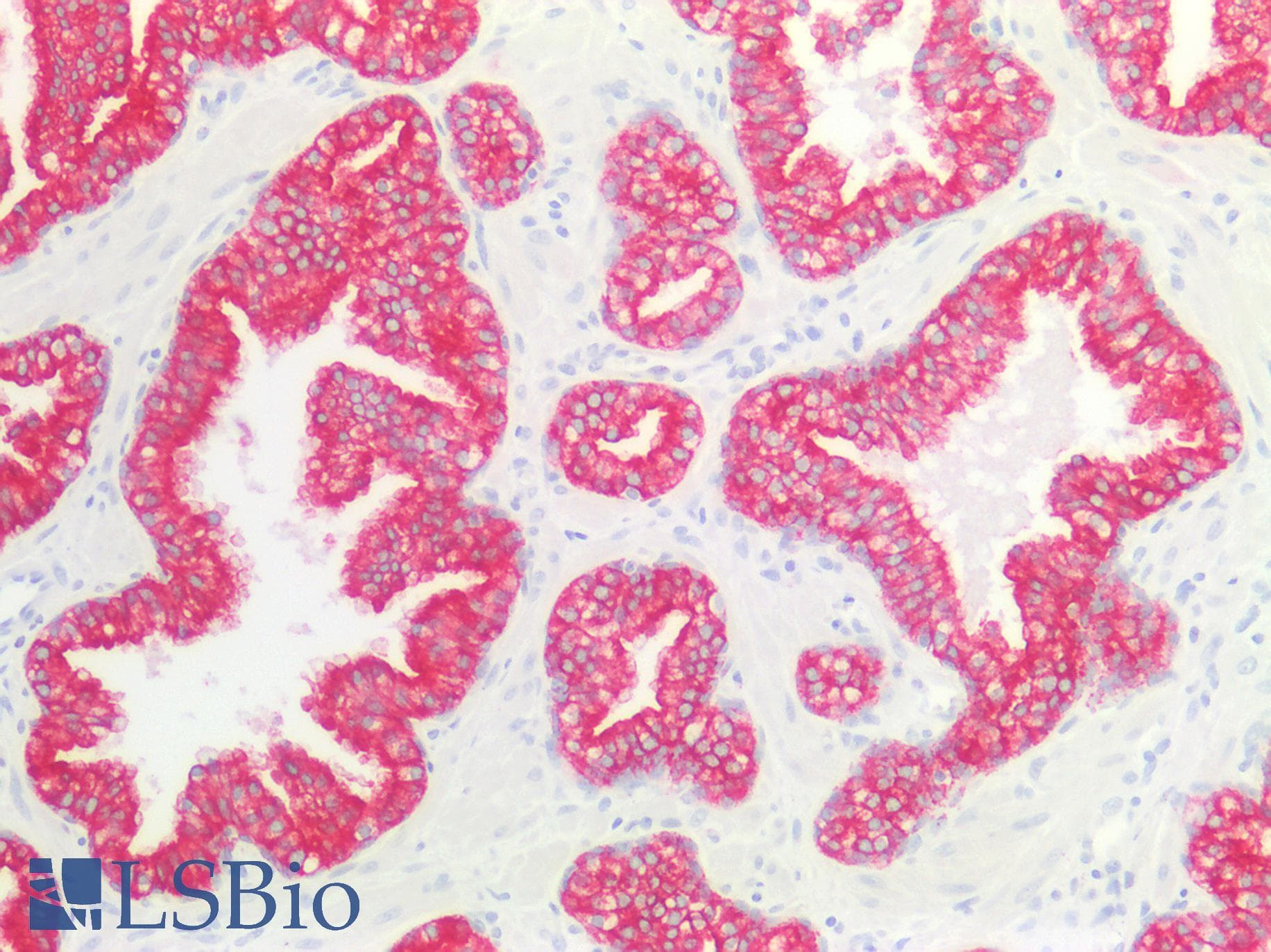 PathPlus™ Cytokeratin 4+5+6+8+10+13+18 Antibody (clone C11)