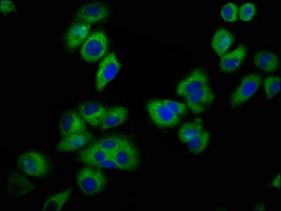 Polyclonal Rabbit anti-Human KCNJ5 / Kir3.4 / GIRK4 Antibody (IHC, IF, WB)