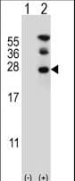 RAN Antibody (aa12-39)