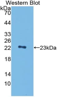 PGLYRP1 / PGRP Antibody (aa19-182)