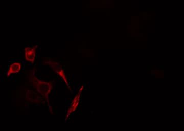 GUCY1B3 Antibody