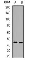 ASAH1 / Acid Ceramidase Antibody