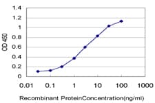 IHC-plus™ CGGBP1 Antibody (clone 1D11)