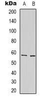 PathPlus™ Polyclonal Rabbit anti-Human PSAP / Prosaposin Antibody (Internal, IHC, WB)