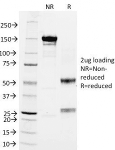 ITGB2 / CD18 Antibody (clone 68-5A5)