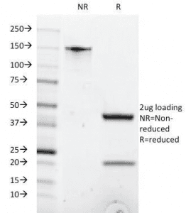 CD8A / CD8 Alpha Antibody (clone C8/1035)