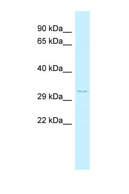 Polyclonal Rabbit anti-Human FOXK2 / ILF Antibody (C-Terminus, WB)