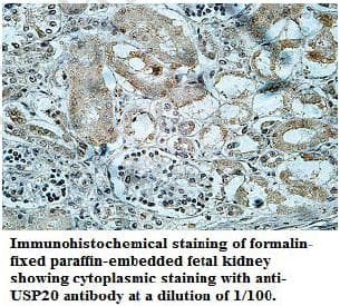 USP20 / VDU2 Antibody (aa2-217)