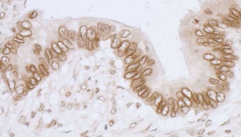 TMPO / TP / Thymopoietin Antibody (aa350-400)