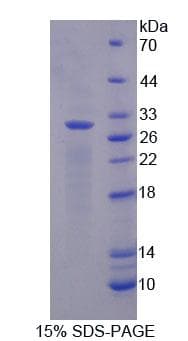 Rat MB / Myoglobin Protein (Native)