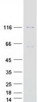 Human CARD14 Protein (Recombinant Myc-DDK (Flag))