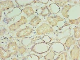 CRADD / RAIDD Antibody (aa1-199)