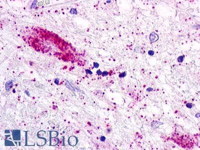 PathPlus™ Polyclonal Rabbit anti-Human ACKR2 / CCR10 / D6 Antibody (N-Terminus, IHC)