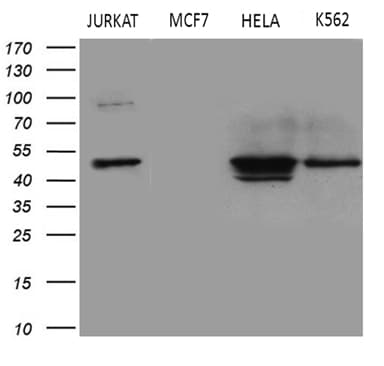 GNAS Antibody (clone OTI7A6)