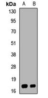 UBE2NL Antibody