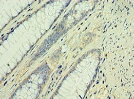 Polyclonal Rabbit anti-Human TAF1B Antibody (aa369-588, IHC, WB)