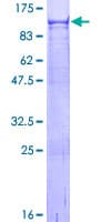 Human VPS52 / SACM2L Protein (Recombinant GST)