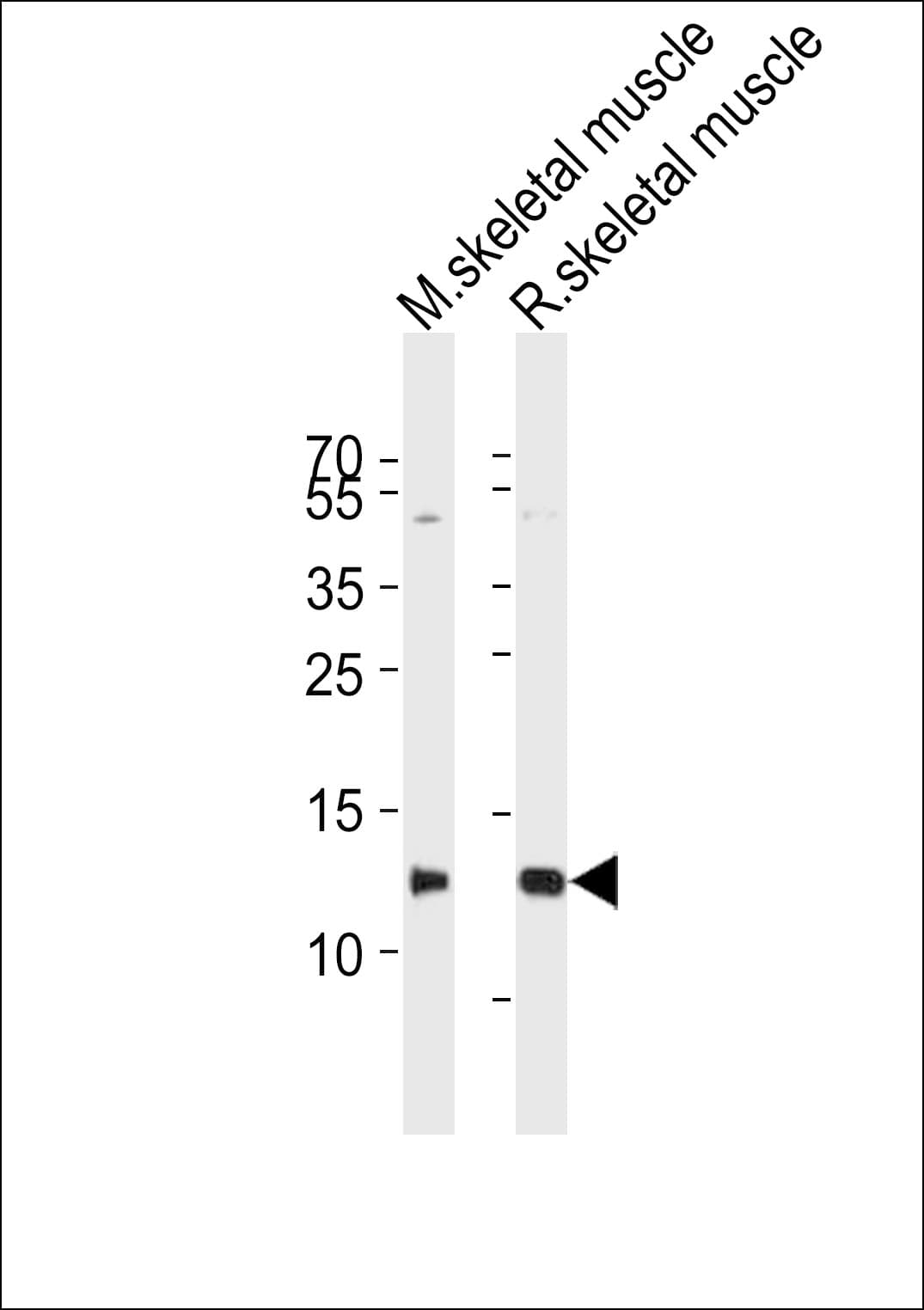 PVALB / Parvalbumin Antibody