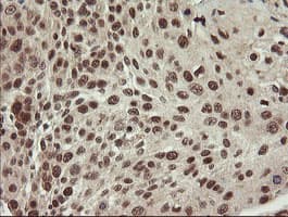 MME / CD10 Antibody (clone OTI3D11)