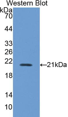 NOS2 / iNOS Antibody (aa43-213)