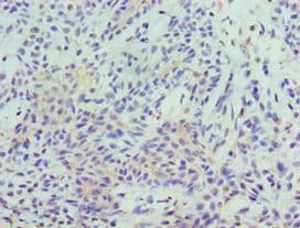 Polyclonal Rabbit anti-Human STAT5B Antibody (aa40-280, IHC, WB)