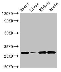 Polyclonal Rabbit anti-Human GUCD1 Antibody (IHC, IF, WB)