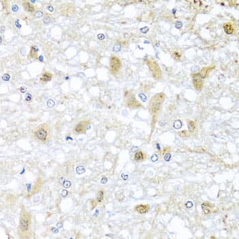 Polyclonal Rabbit anti-Human ATP2C1 Antibody (IHC, WB)