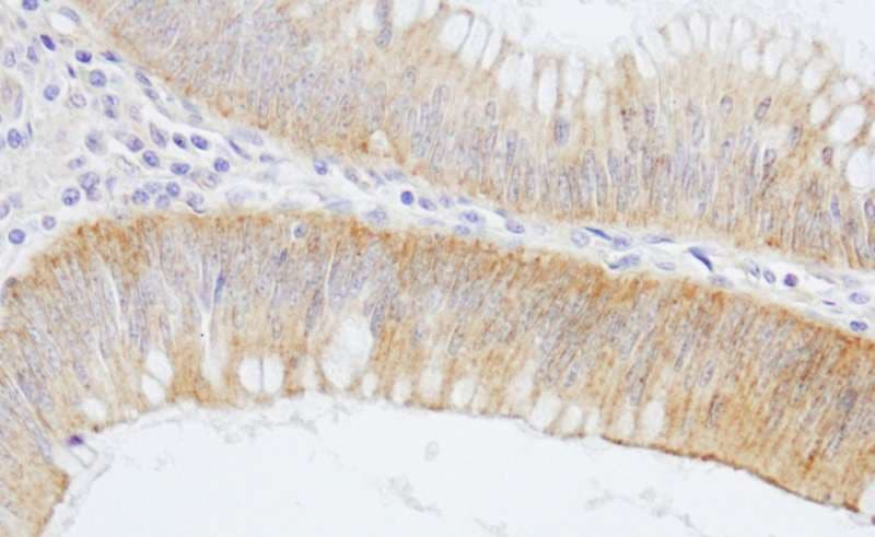 SPTAN1 / Alpha Fodrin Antibody (aa2422-2472)