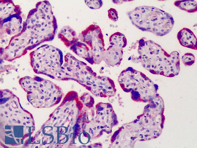 IHC-plus™ ADAM12 Antibody (aa2-14)