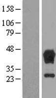 TBCC Protein (Over-Expression Lysate Myc-DDK (Flag))