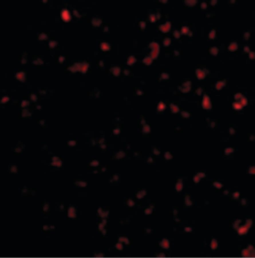 IHC-plus™ Polyclonal Rabbit anti-Human BIK Antibody (IHC, IF, WB)