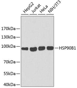 HSP90B1 / GP96 / GRP94 Antibody