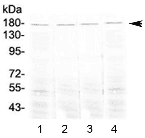 ACE / CD143 Antibody