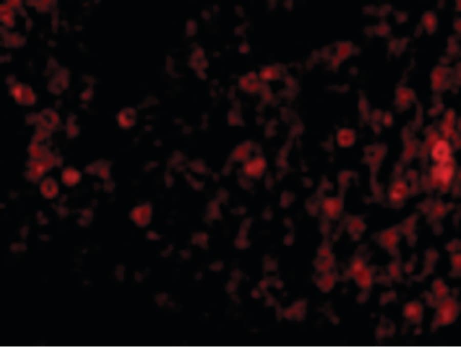 IHC-plus™ EIF2AK2 / PKR Antibody