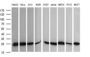 RALB Antibody (clone OTI2C4)