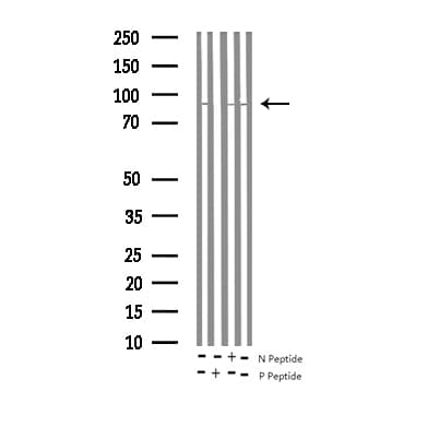 PRKCA / PKC-Alpha Antibody (phospho-Thr497)