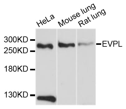 Polyclonal Rabbit anti-Human EVPL / Envoplakin Antibody (WB)