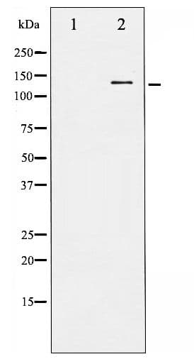 c-Kit / CD117 Antibody (phospho-Tyr703)